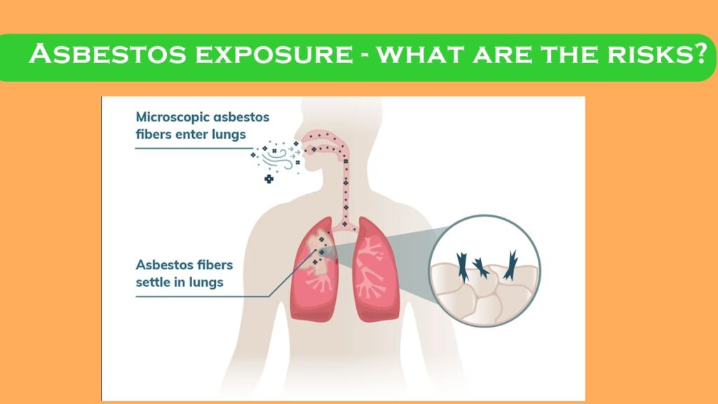 Asbestos exposure - what are the risks?