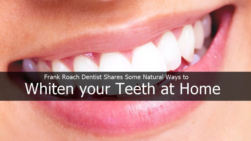 Frank Roach Dentist Shares Some Natural Ways to Whiten your Teeth at Home