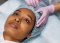 8 Top Benefits of Adding Dermal Fillers to Your Beauty Regimen