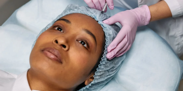 8 Top Benefits of Adding Dermal Fillers to Your Beauty Regimen