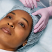 8 Top Benefits of Adding Dermal Fillers to Your Beauty Regimen